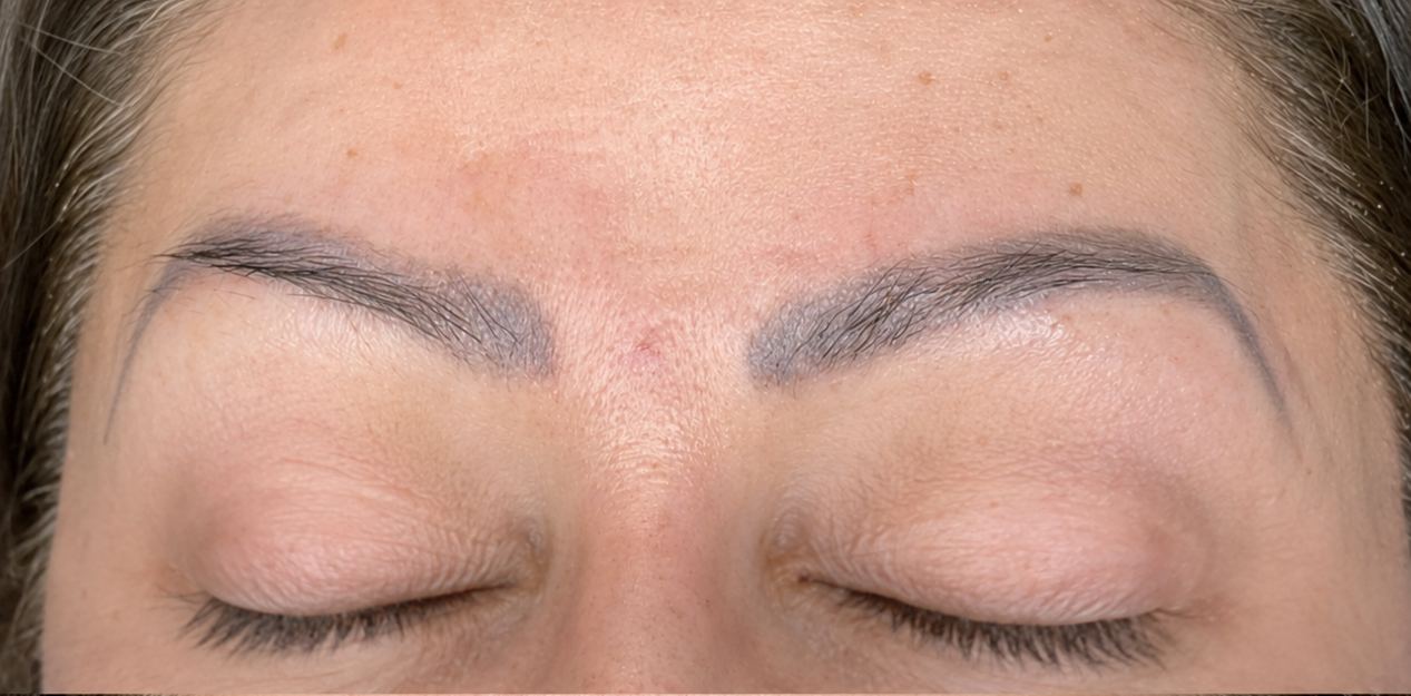 Öncesi